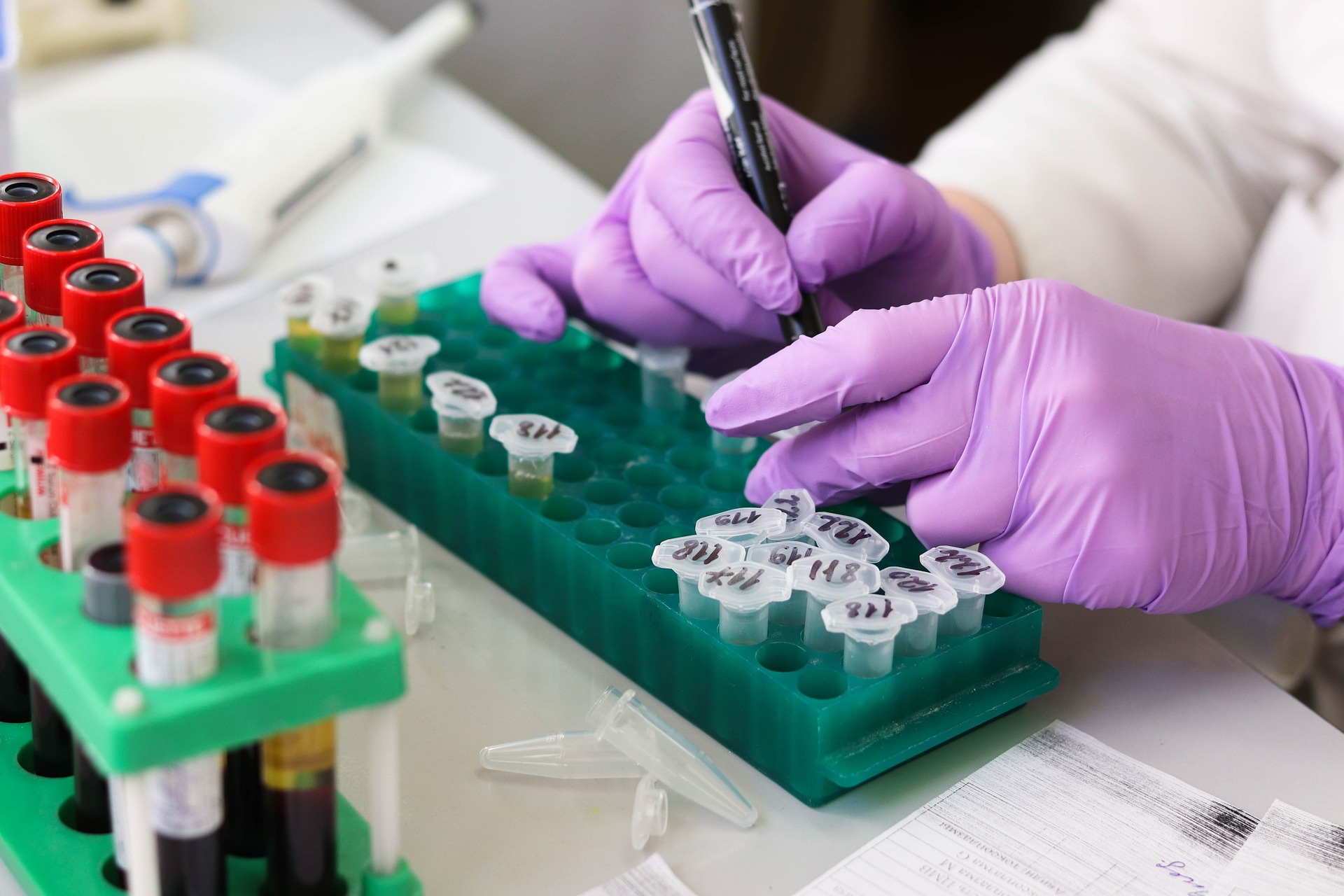 Výter z nosa alebo testovanie z slín dokáže ovplyvniť rozšírenie pandémie